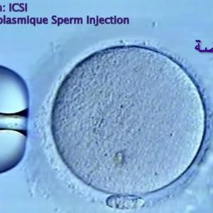 Pourquoi l'ICSI, pour qui ?